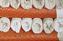 Expanded wire mesh